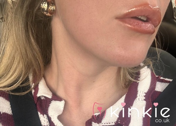 Make My Lips Juicy - Treats For You 😉