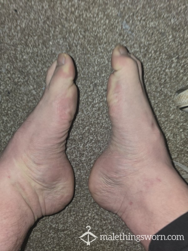 Me Rubbing My Feet