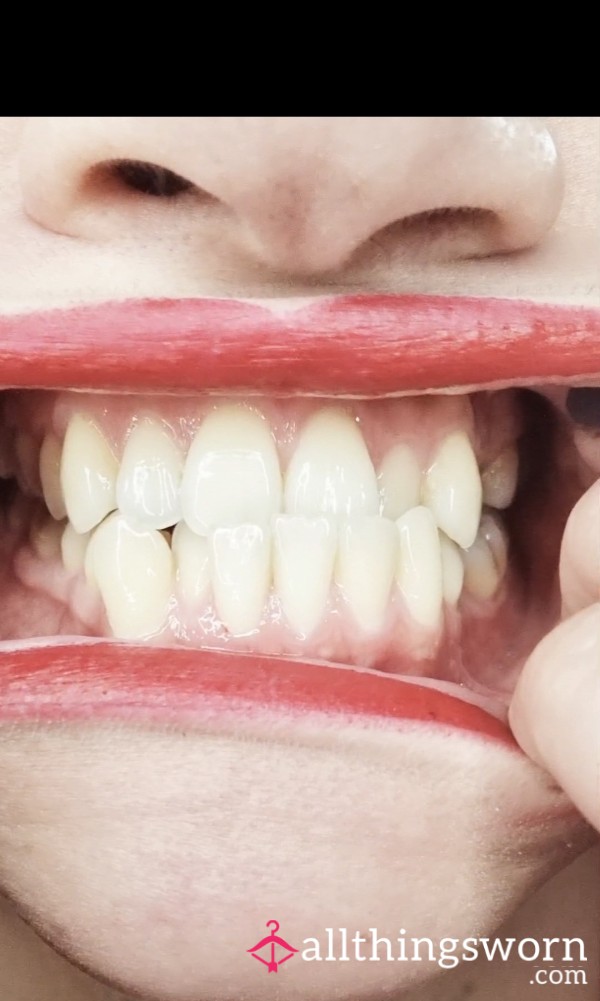 Mouth Inspection Close Up HD Detailed