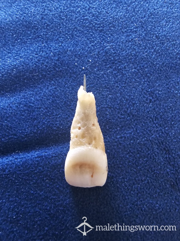 My 30 Year Old False Tooth