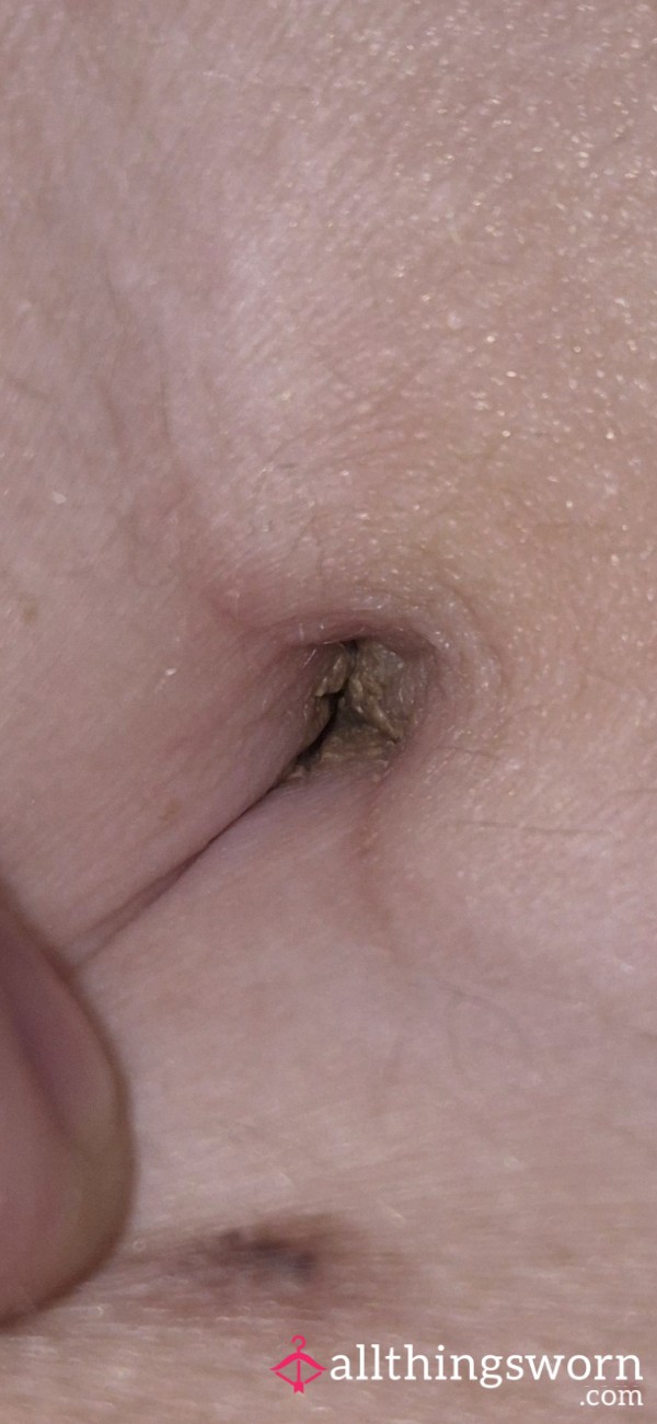 My Dirty Belly Bu*ton