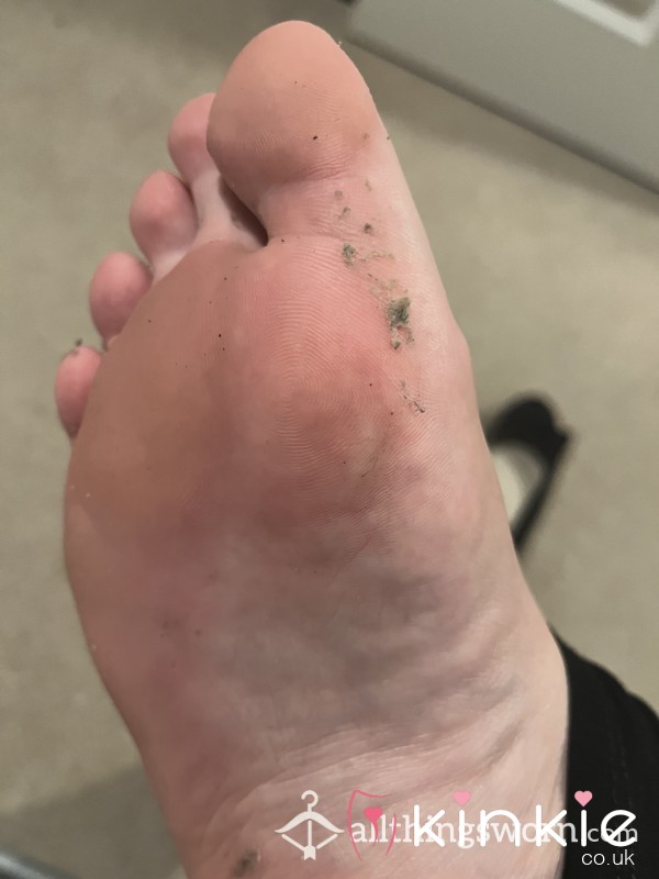 My Disgusting Sweaty Toe Jam! 🤢🧀🦶