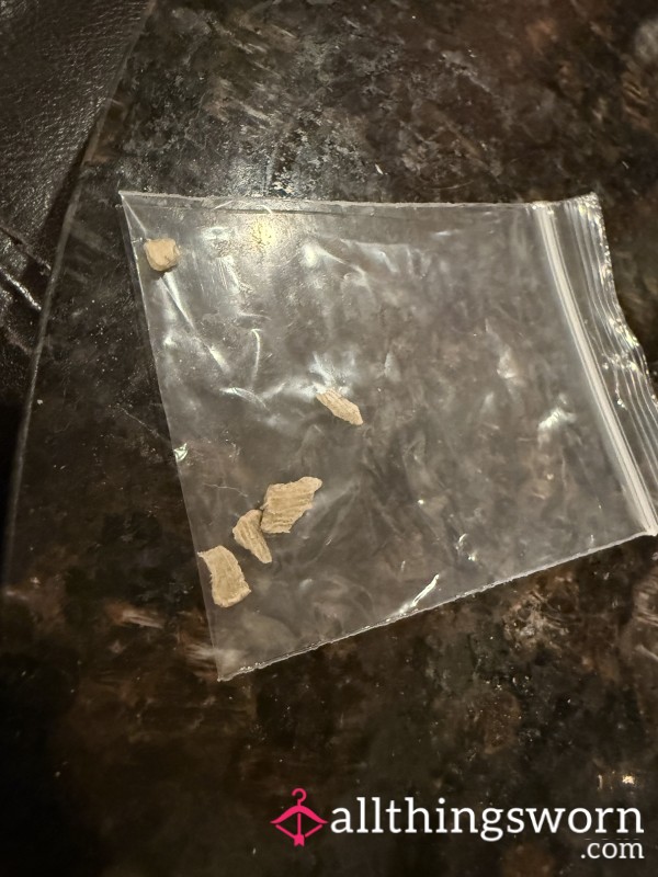 My Dry Cracked Heels Before I Got A Pedicure