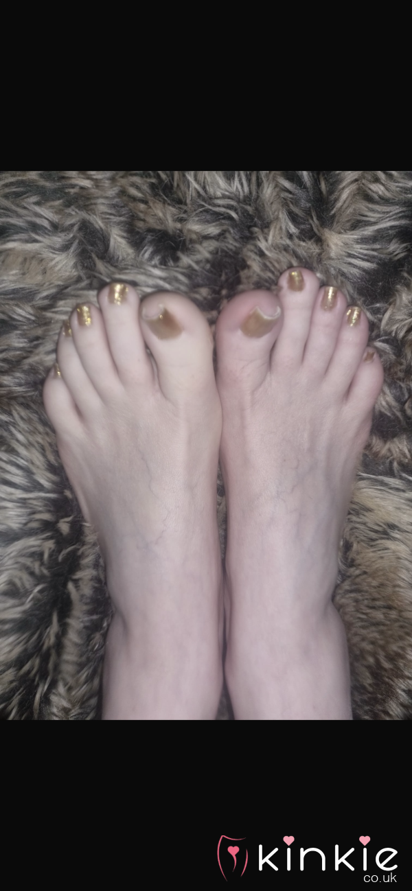 My S**y Feet Pics X