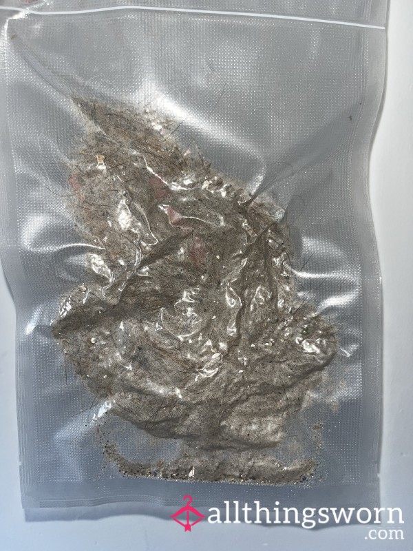 My Skin Cells And Other Vacuum Trash