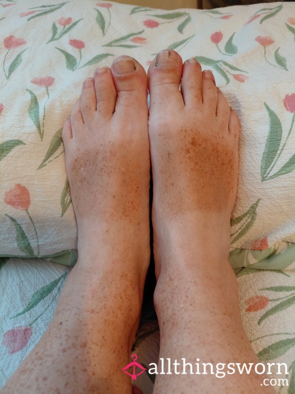 My Striped Tan Feet Lol Sandals Marks Make Them Unique To Me