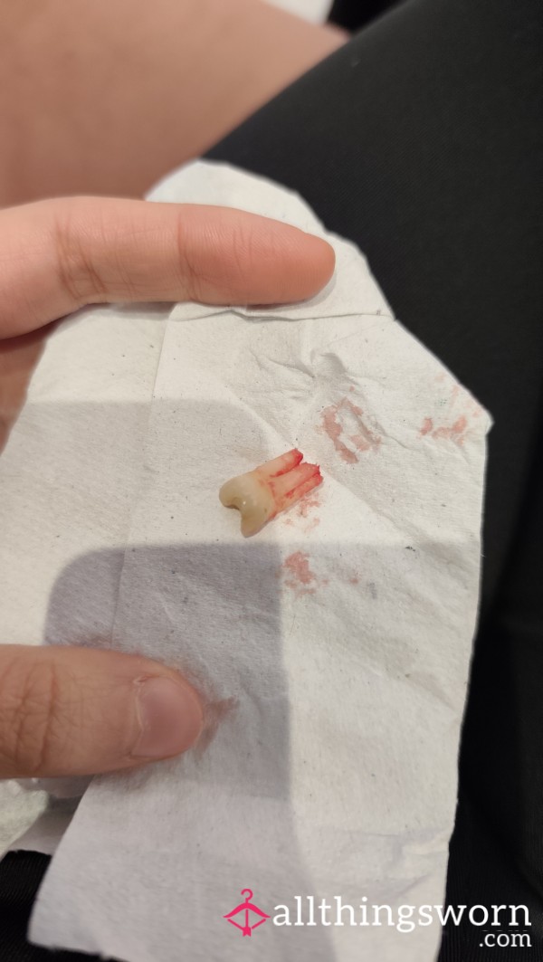 My Wisdom Tooth🦷