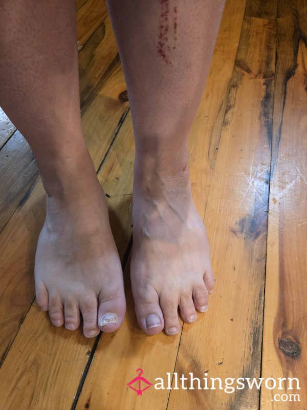 Need A Polish After Injury