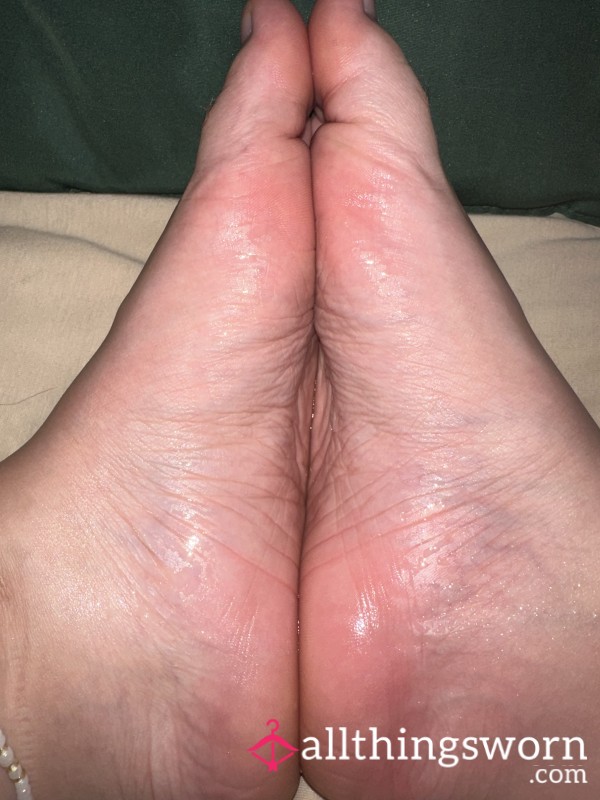 Neglected Feet
