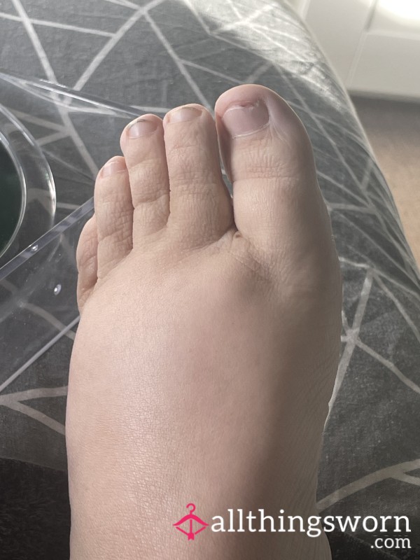 Not The Best Feet