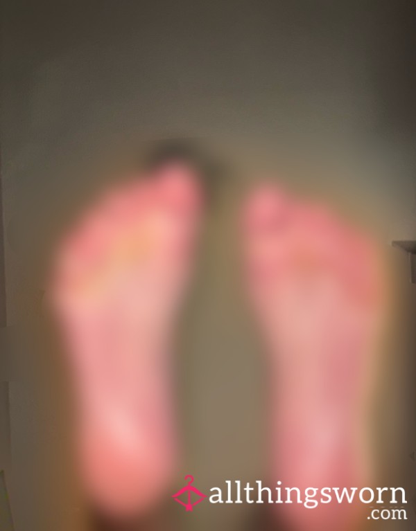 Oily Feet