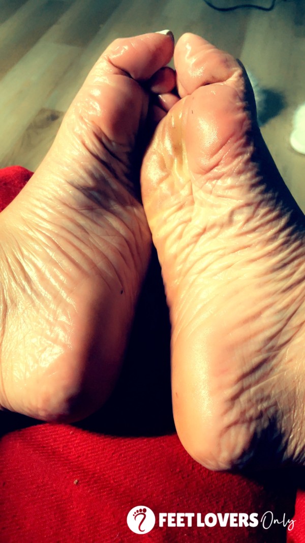 Oily Soles And Feet White Tips