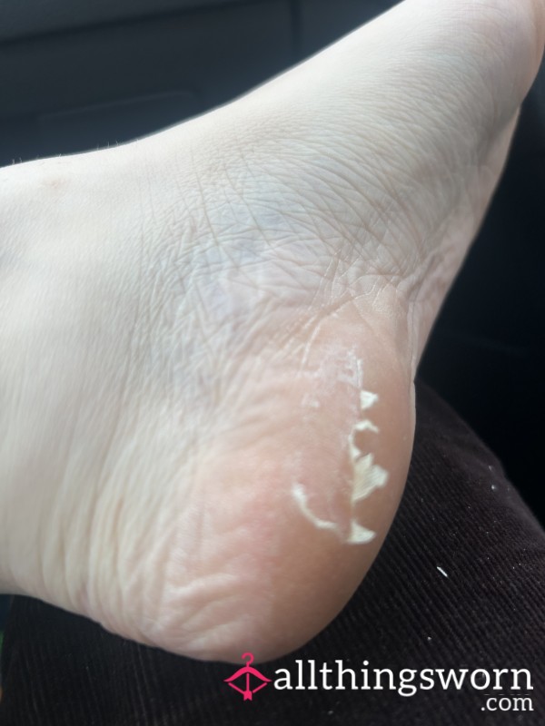 Ouch Sore Foot