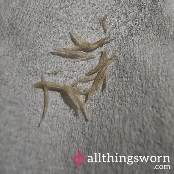 Overgrown Cuticle Trimmings