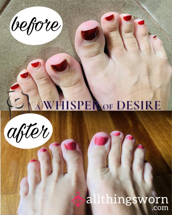 Pedicure Intimacy: Before, During & After Photo Bundle 💅