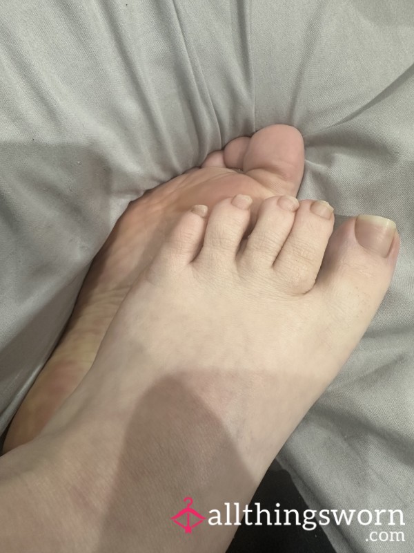 Pedicure Needed