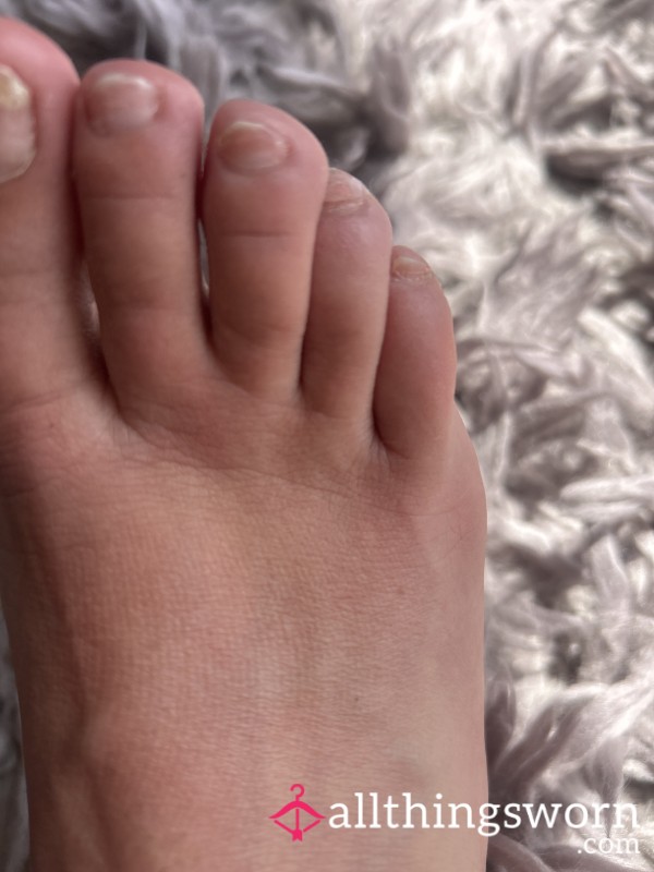 Pedicure Needed Asap