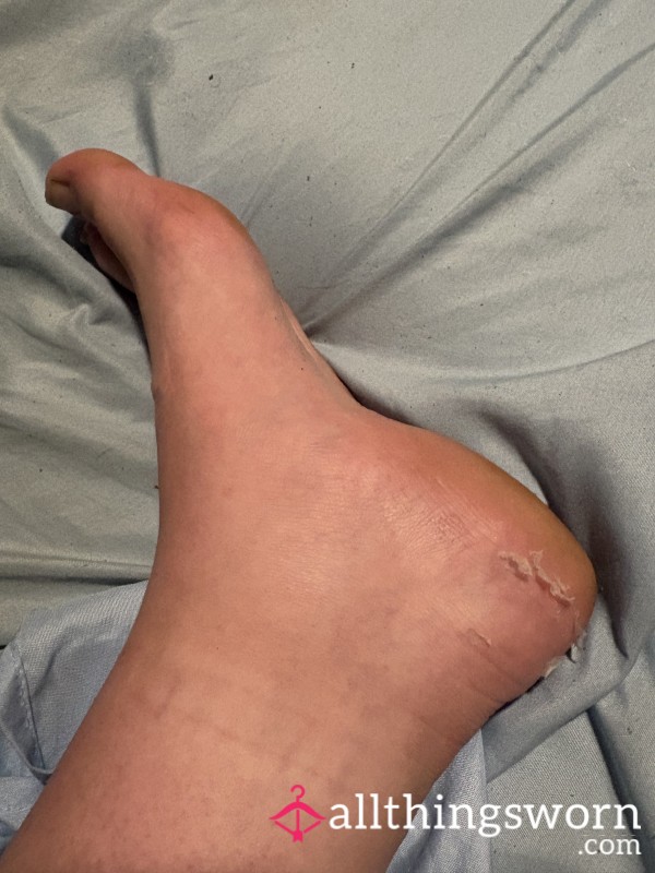 P**ling Foot Skin