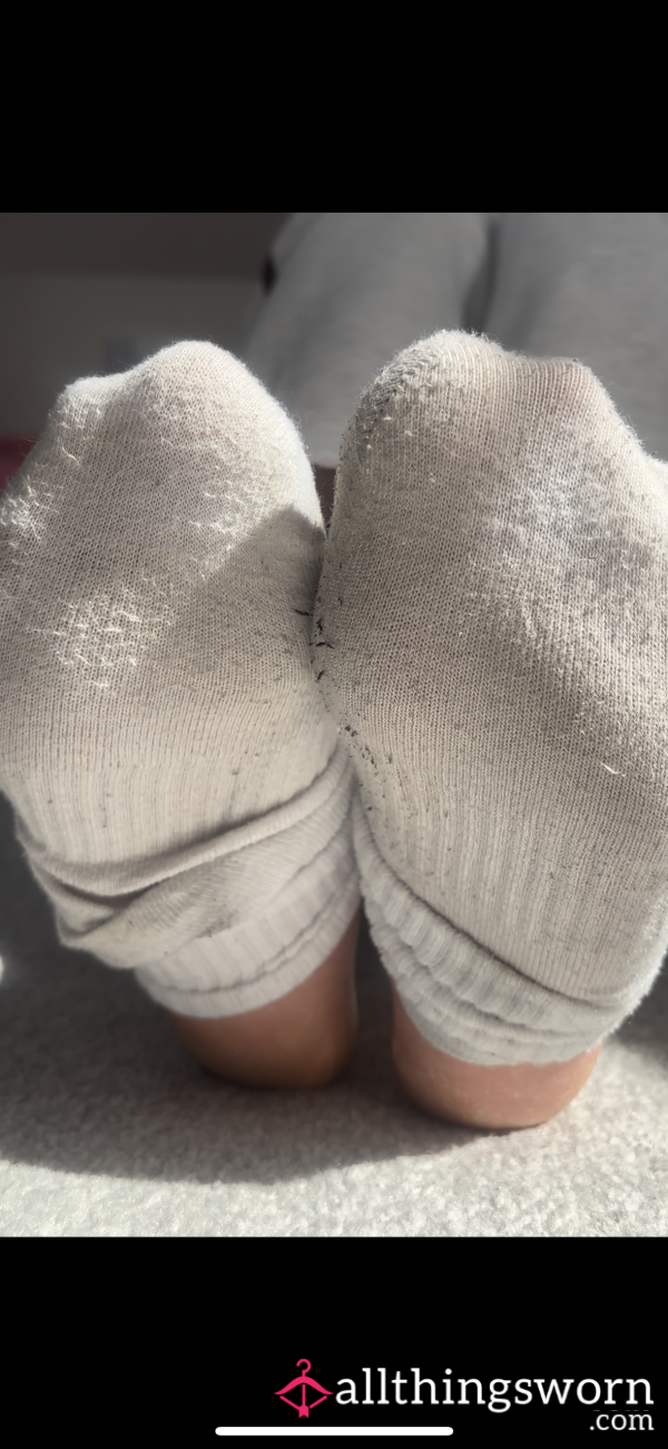 Revealing My Dry Soles 😜