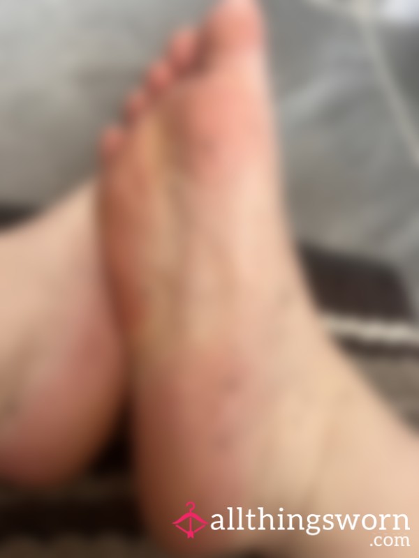 Pic Of My Dead Skin On My Feet From My Foot P**l🦶🏼