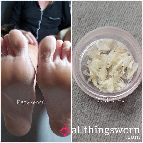 Piggy Scratchings Anyone. 2 X Pots Of Foot P**l