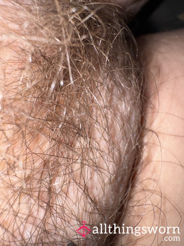 Pubic Hair