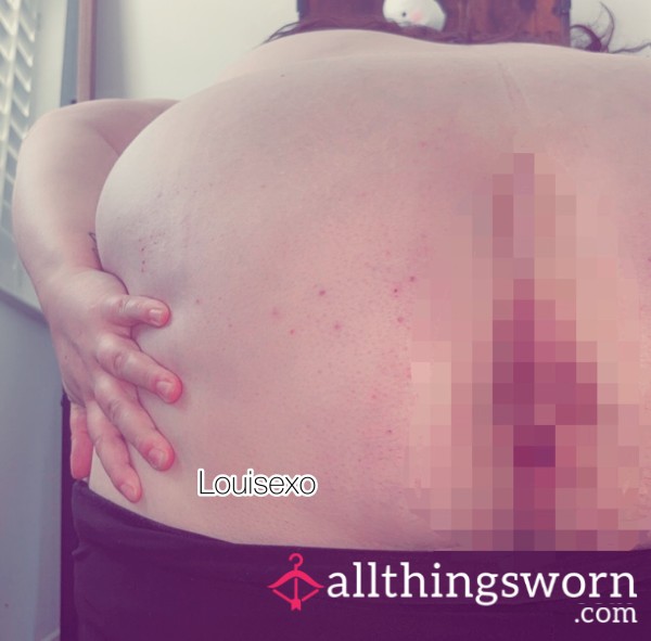 Rate My Arsehole 💁‍♀️ ( Sufficient Wrinklage As Told By Another Person ) 😏