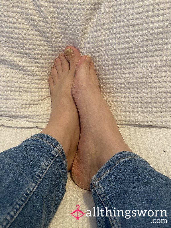 Raw & Real Feet – Damaged Nails + Dry Heels | Instant Pics