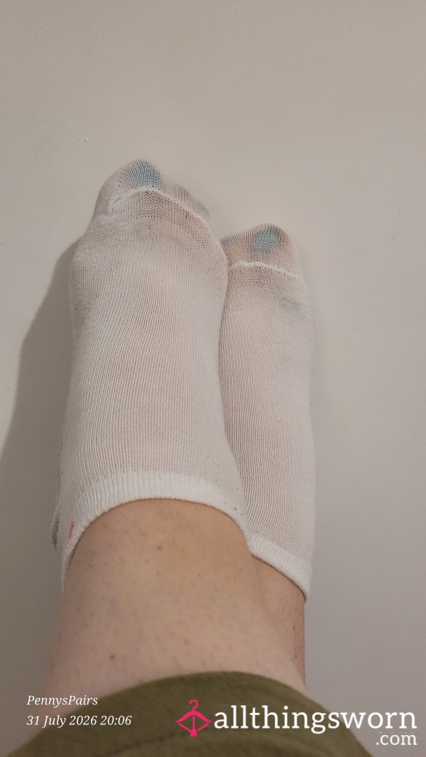 Remove My Worn Socks With Me And See Those Webbed Toes For Yourself 😘
