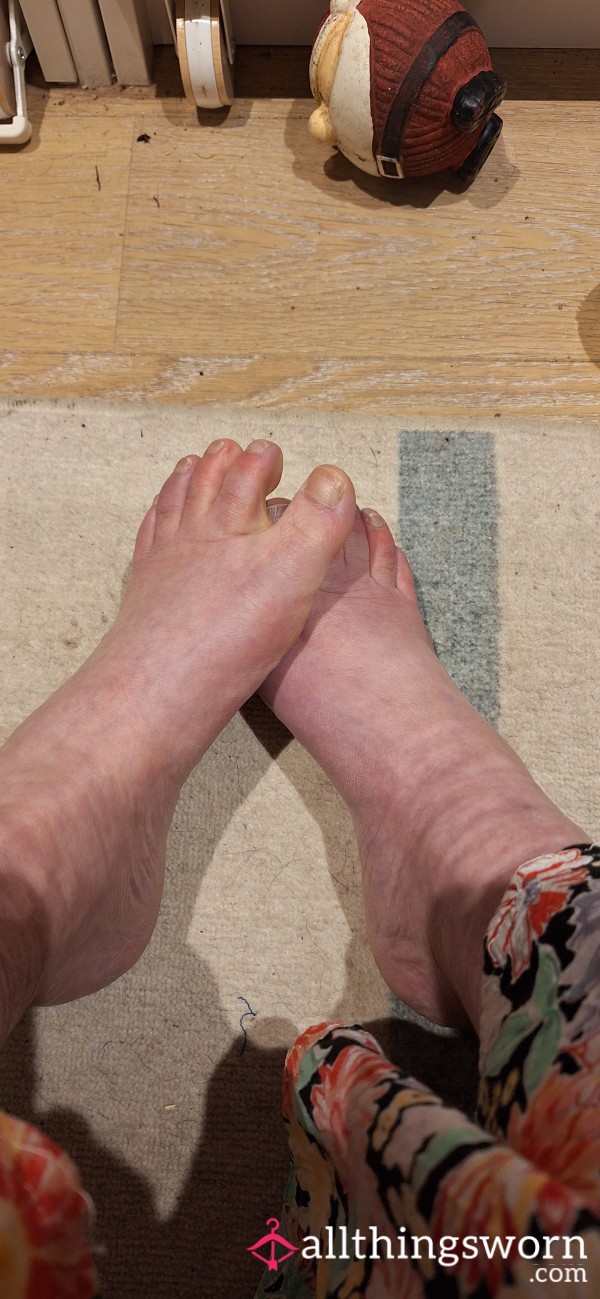 Rough Feet