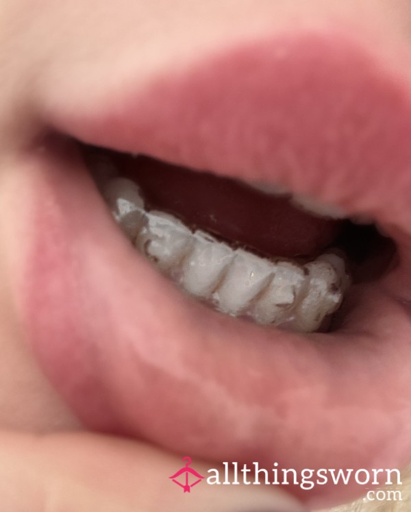 Saliva Covered Invisalign Tray
