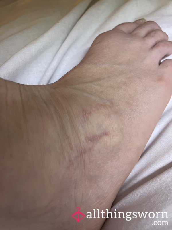Scarred Foot Ready To Be Licked