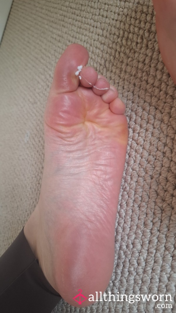 See My Feet After A 5k Run