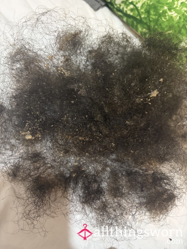 Shedded Hair & Scalp Gunk- 6 Week Build Up!