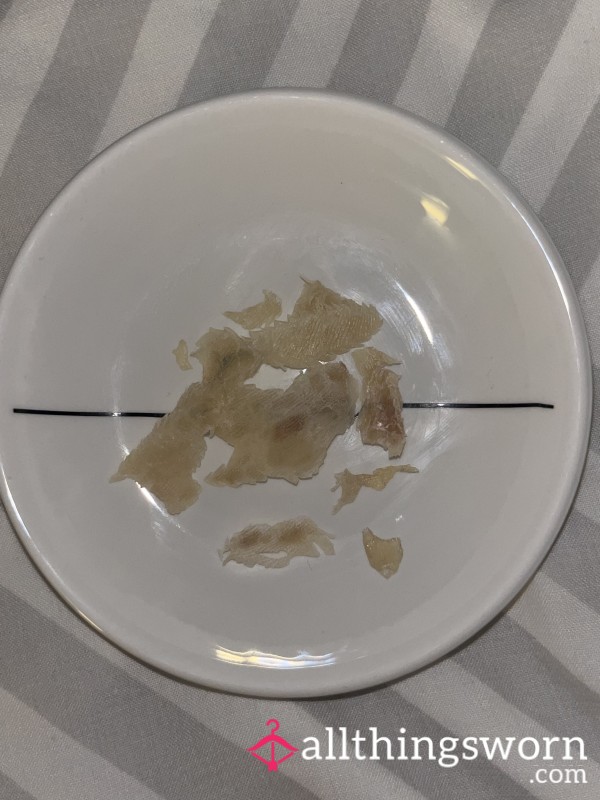Skin Clippings From Running Callous