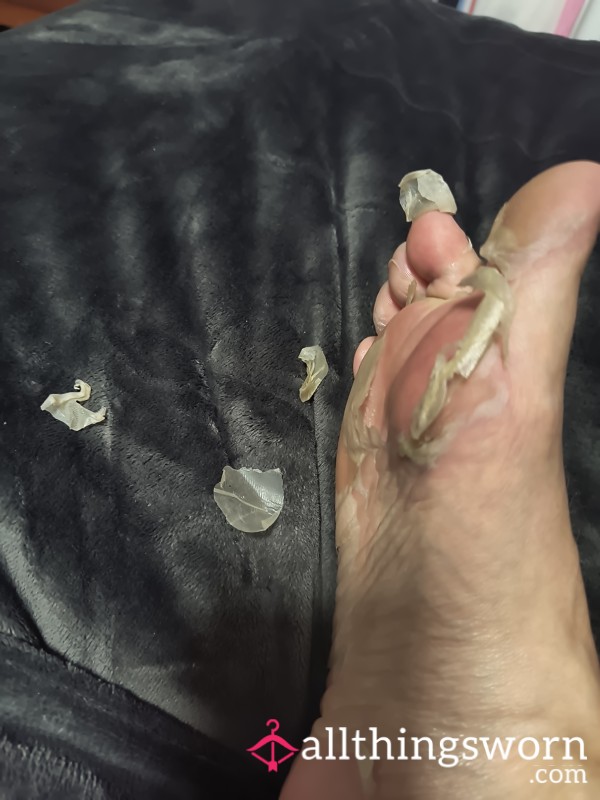 Skin From My Foot P**l