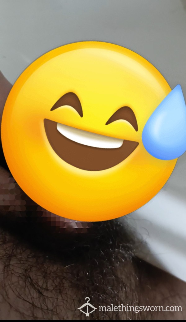 Smegma