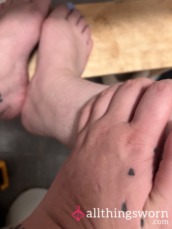 Sock Imprints On Leg