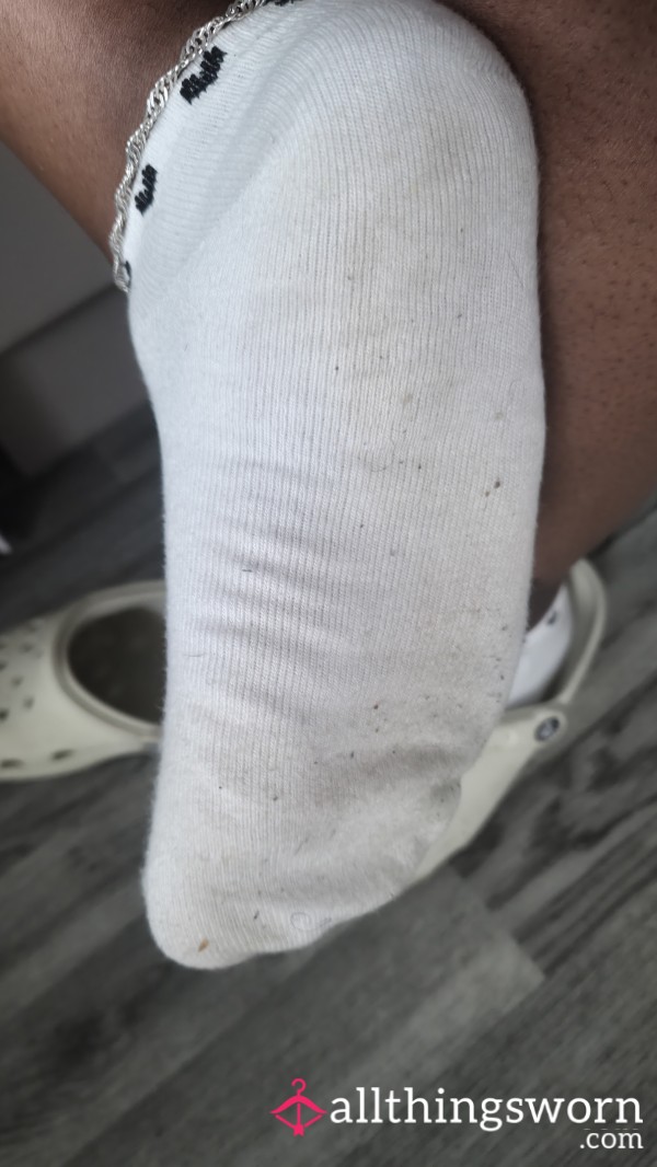 Socks Worn All Day In 30° Weather.. Sweaty And Smelly.