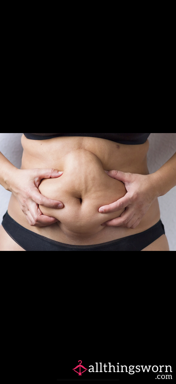Soft, Squishy & Real – My Loose Belly Skin After Weight Loss 💫