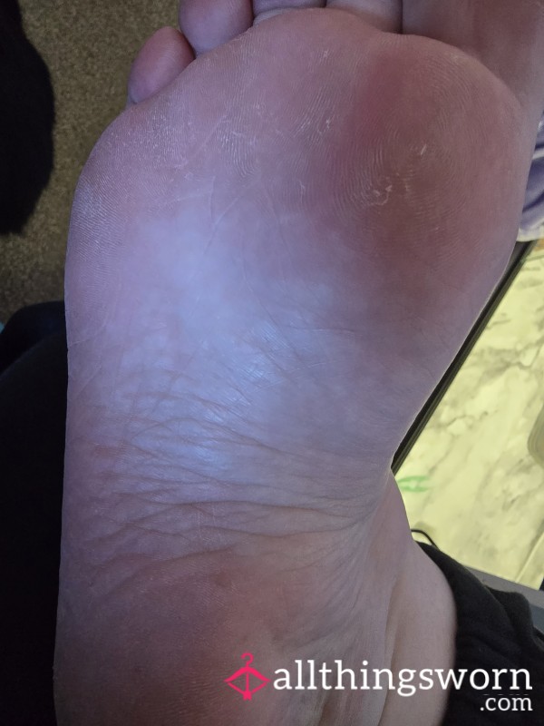 Sole Of My Slightly Dry Foot.