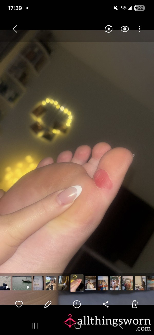 Sore Feet