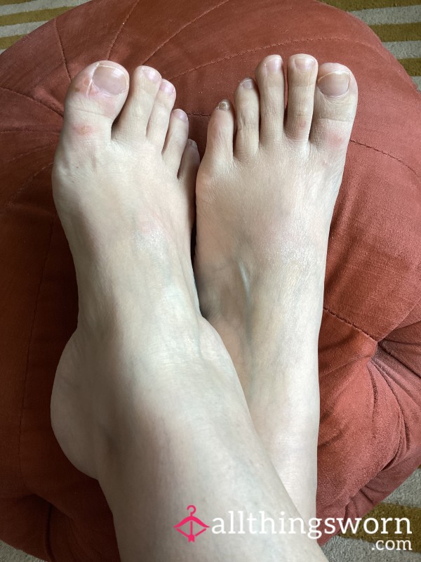 Sore Feet Photo Set — Natural Blisters & Tired Soles