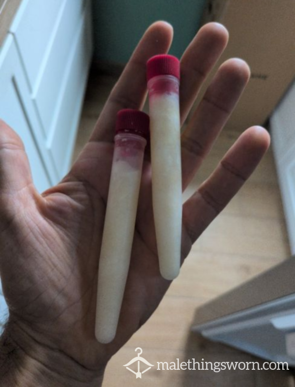Sperma