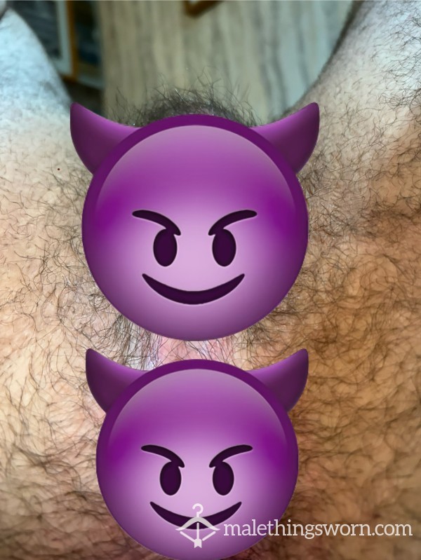 Sphincter Opened Part One: A Close Look In My A**hole