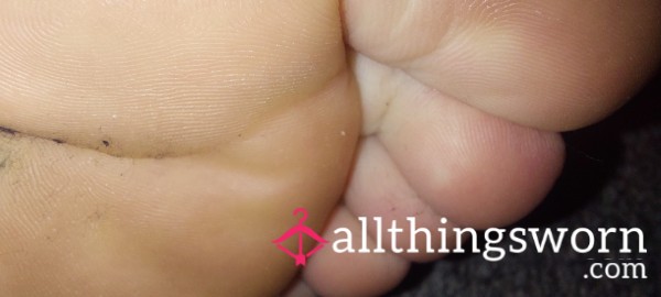 Squishy Toe Pads 😍