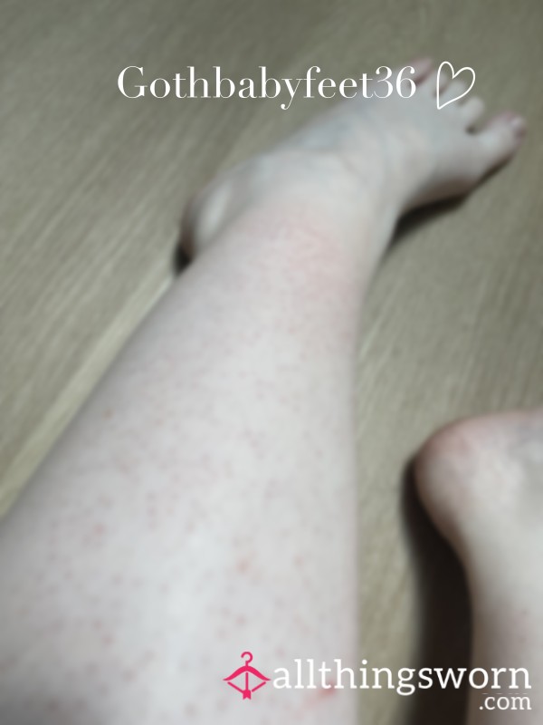 Strawberry Skin 🍓