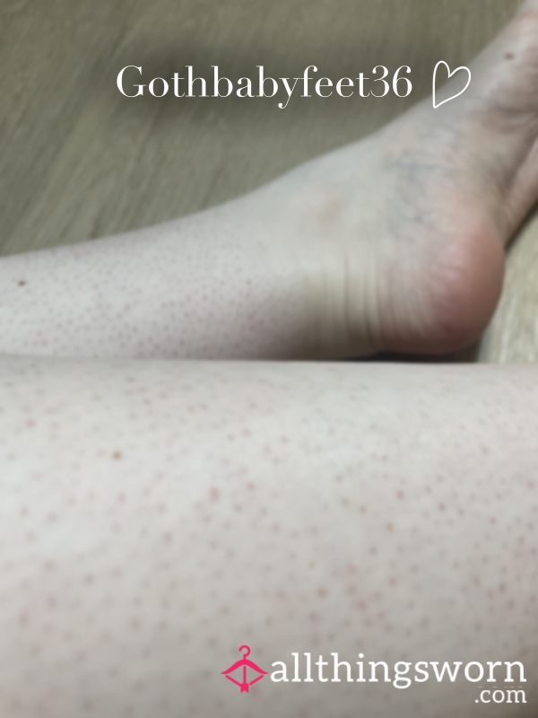 Strawberry Skin 🍓