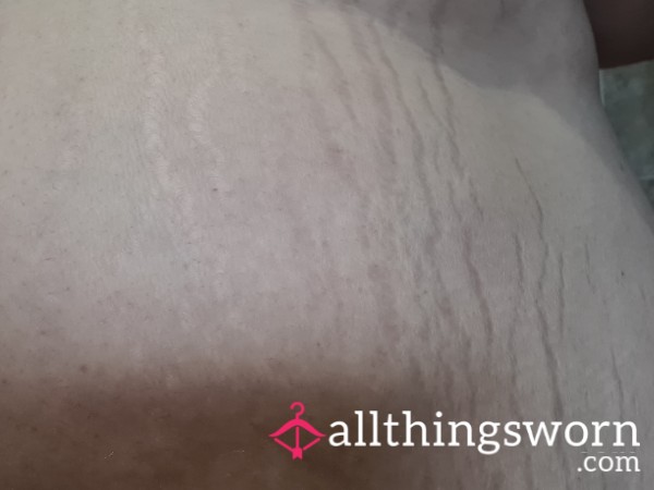 Stretch Mark Appreciation