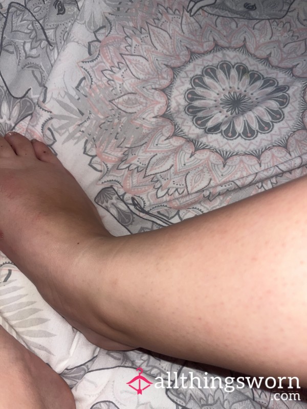 Sweating Feet Chipped Nails